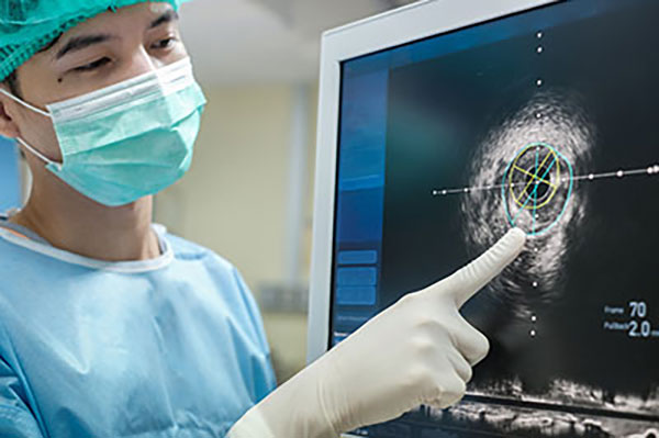Vascular Ultrasound