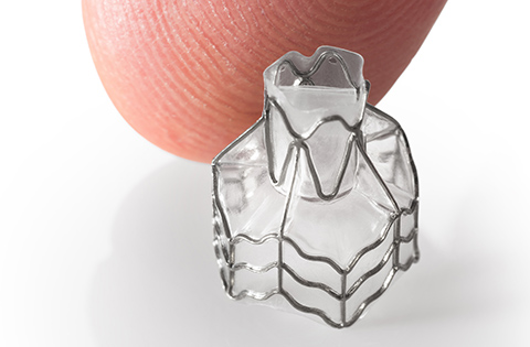 Endobronchial Valves